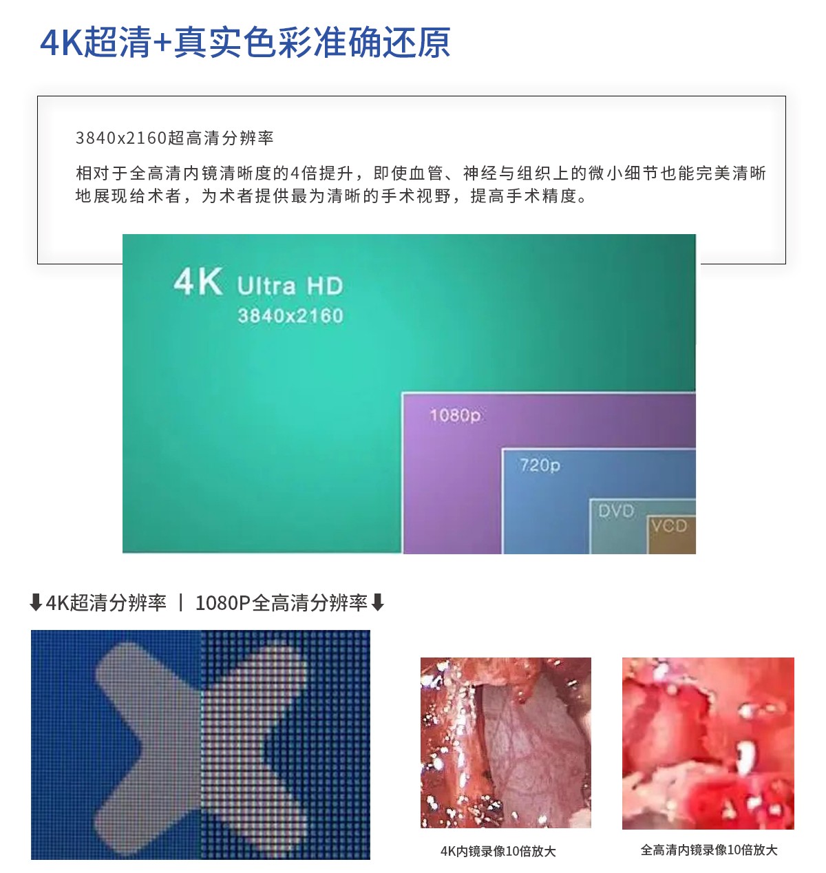 【4K醫用內窺鏡攝像系統】您的第一臺“4K”找到了嗎？