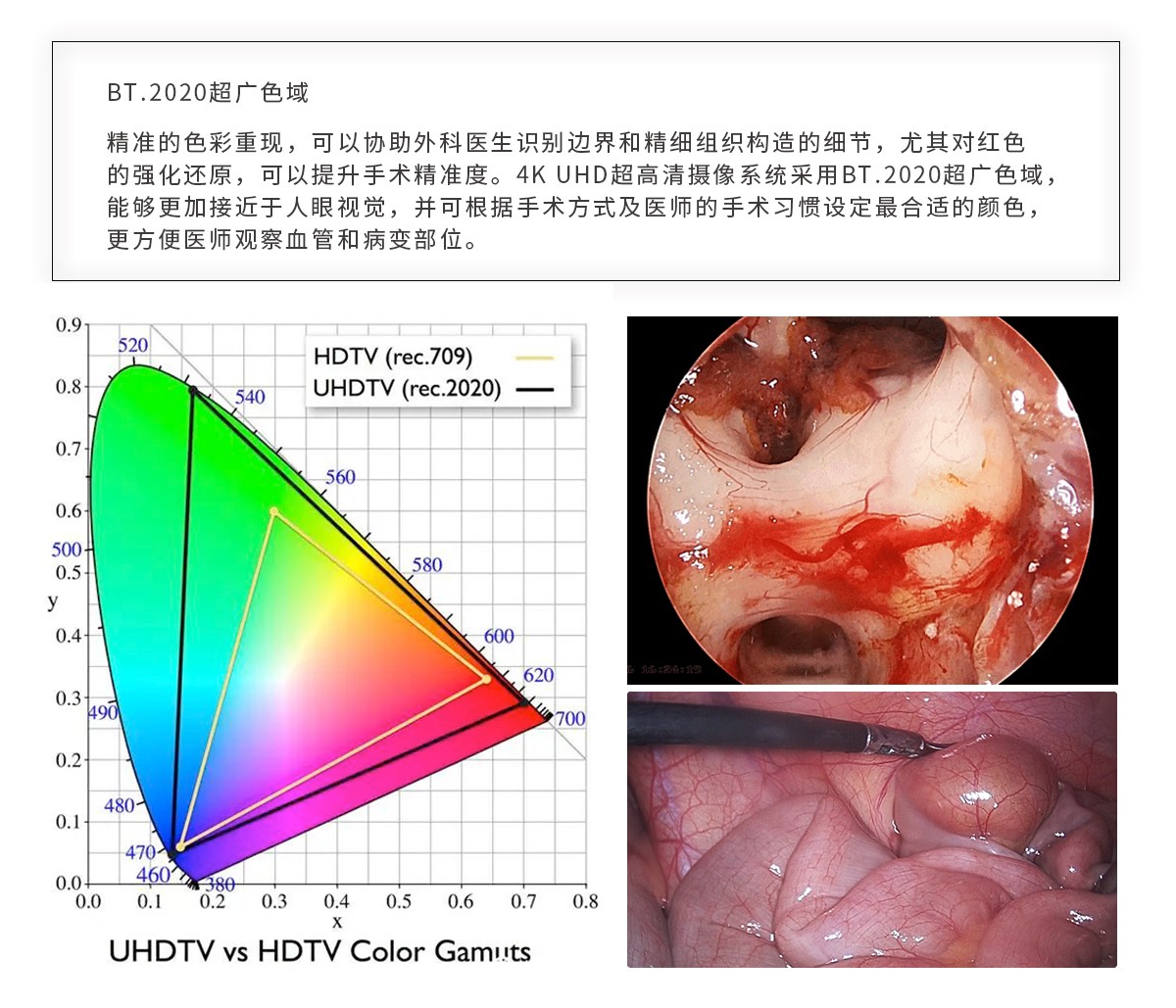 【4K醫用內窺鏡攝像系統】您的第一臺“4K”找到了嗎？
