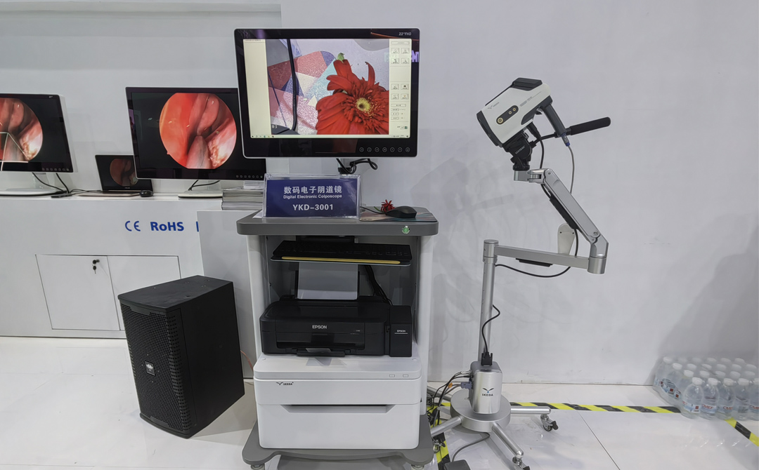 數碼電子陰道鏡 數碼電子陰道鏡