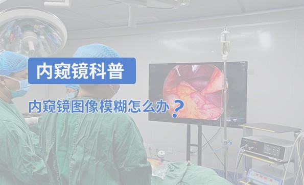 內窺鏡科普：內窺鏡圖像模糊怎么辦？