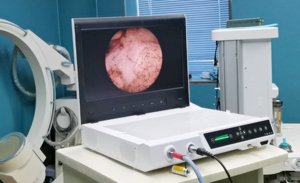 一文了解關(guān)節(jié)鏡系統(tǒng)的構(gòu)成、應(yīng)用、操作流程